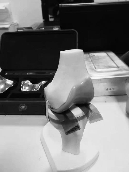 黃維團隊與西安紅會醫院開展合作，推動柔性電子在輔助膝關節置換手術中的應用